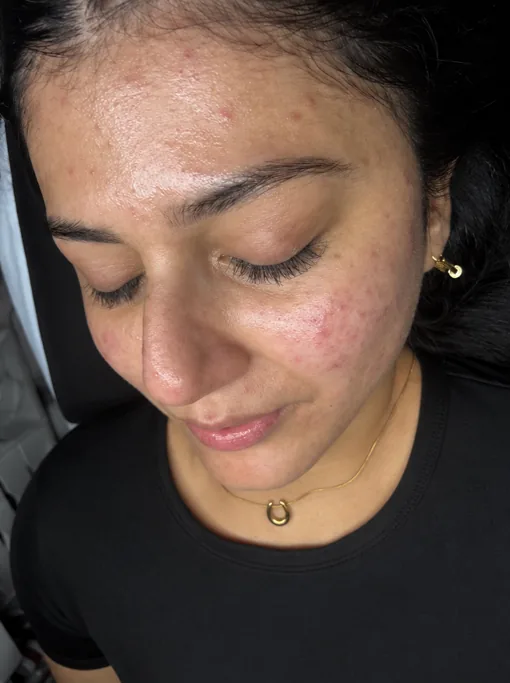 Before: A client’s brows