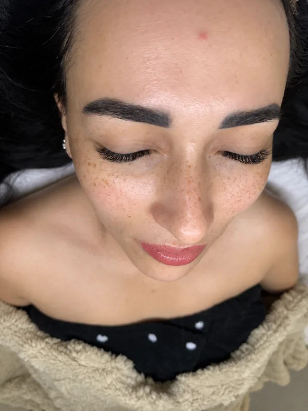Before: A client’s brows and skin