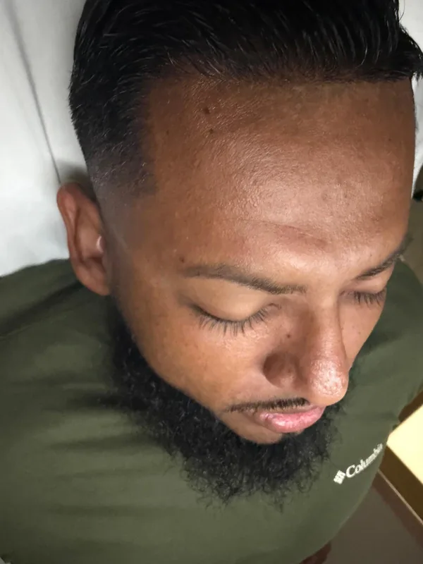 After: A gentleman’s skin
