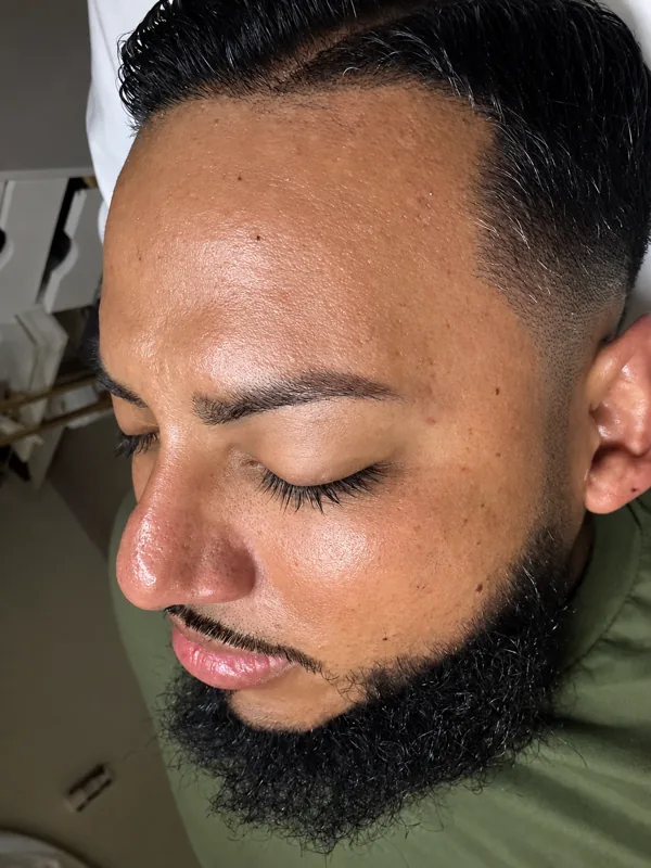 Before: A gentleman’s skin